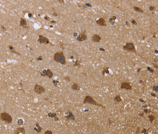 Immunohistochemistry of paraffin-embedded Human brain  tissue using GADD45B Polyclonal Antibody at dilution 1:30