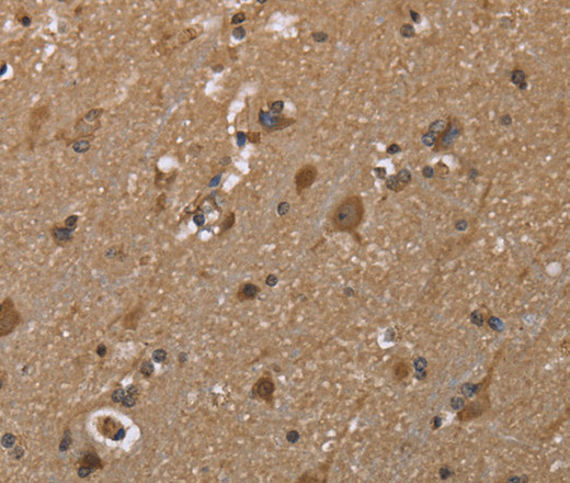 Immunohistochemistry of paraffin-embedded Human brain  using GALK1 Polyclonal Antibody at dilution of 1:40