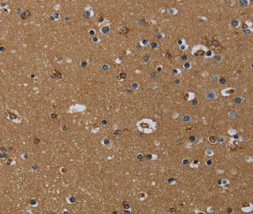 Immunohistochemistry of paraffin-embedded Human brain  tissue using GBP5 Polyclonal Antibody at dilution 1:40