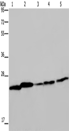 Western Blot analysis of Mouse spleen tissue, A375, A549, HT-29 and Hela cell using ARHGDIA Polyclonal Antibody at dilution of 1:350