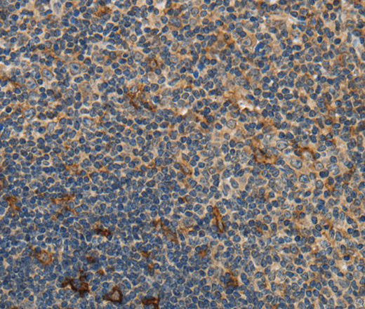 Immunohistochemistry of paraffin-embedded Human tonsil using GGT1 Polyclonal Antibody at dilution of 1:40