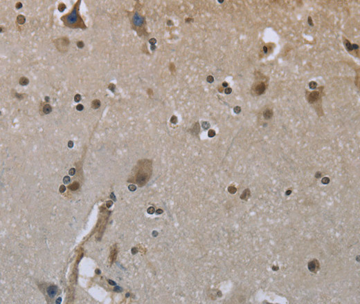 Immunohistochemistry of paraffin-embedded Human brain using GYS1 Polyclonal Antibody at dilution of 1:50