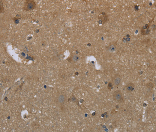 Immunohistochemistry of paraffin-embedded Human brain  tissue using GYS2 Polyclonal Antibody at dilution 1:50