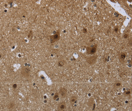 Immunohistochemistry of paraffin-embedded Human brain tissue using CD236 Polyclonal Antibody at dilution 1:60