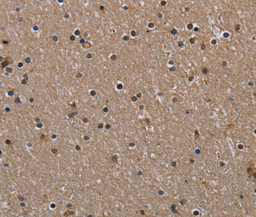 Immunohistochemistry of paraffin-embedded Human brain tissue using HIF1 alpha Polyclonal Antibody at dilution 1:60