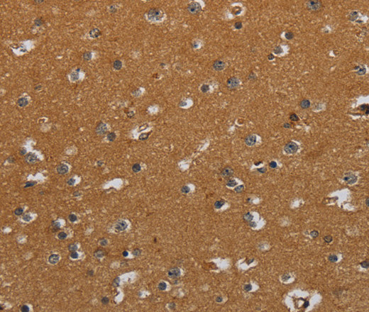 Immunohistochemistry of paraffin-embedded Human brain using CSH1 Polyclonal Antibody at dilution of 1:40