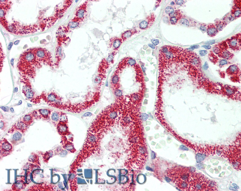 Immunohistochemistry of paraffin-embedded Human Kidney using HSD17B8 Polyclonal Antibody at dilution of 1:100.