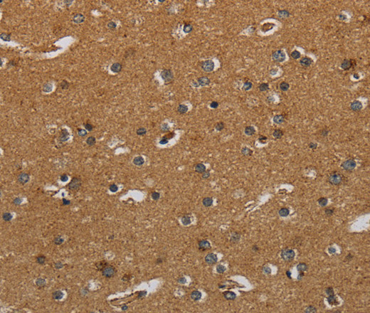 Immunohistochemistry of paraffin-embedded Human brain  using HSD17B2 Polyclonal Antibody at dilution of 1:50