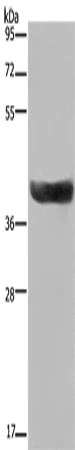 Western Blot analysis of Human fetal liver tissue using HSD17B2 Polyclonal Antibody at dilution of 1:300