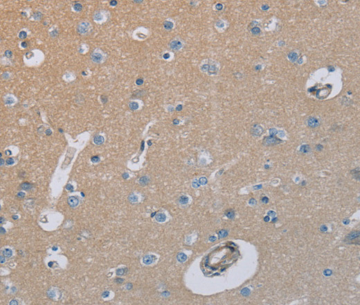 Immunohistochemistry of paraffin-embedded Human brain  tissue using HSD3B7 Polyclonal Antibody at dilution 1:40