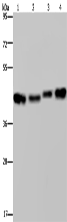 Western Blot analysis of HepG2, Raji, A431 and 231 cell using HSP40-4 Polyclonal Antibody at dilution of 1:800