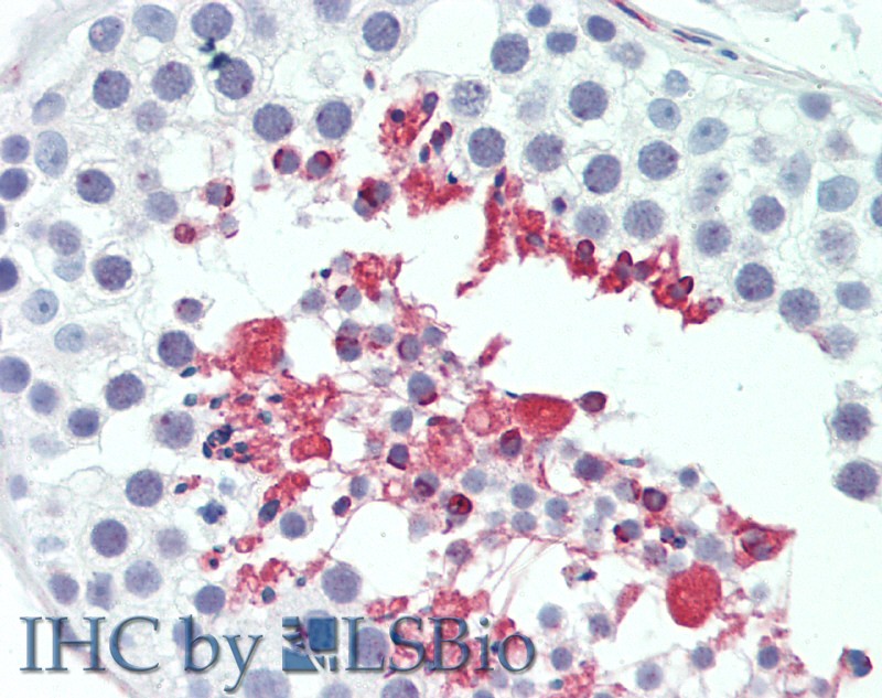 Immunohistochemistry of paraffin-embedded Testis tissue using LIPE Polyclonal Antibody at dilution of 1:100.