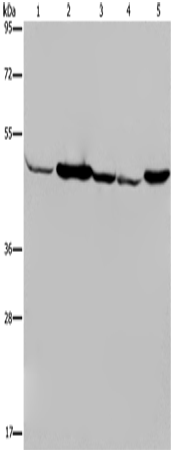 Western Blot analysis of Human fetal muscle tissue, Jurkat and 293T cell, Hela cell and Mouse liver tissue using IDH2 Polyclonal Antibody at dilution of 1:600