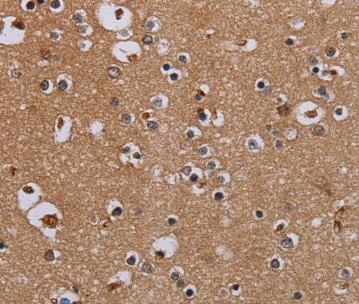 Immunohistochemistry of paraffin-embedded Human brain  tissue using IFRD1 Polyclonal Antibody at dilution 1:40