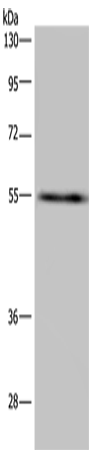 Western Blot analysis of A549 cell using IMPDH2 Polyclonal Antibody at dilution of 1:650