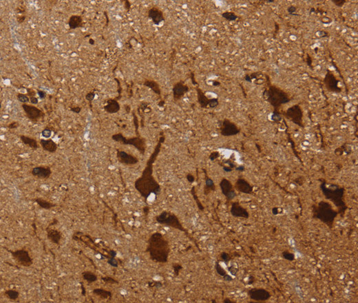 Immunohistochemistry of paraffin-embedded Human brain using KARS Polyclonal Antibody at dilution of 1:60