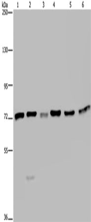 Western Blot analysis of K562, A549, HT-29, 293T, Hela and Jurkat cell using KARS Polyclonal Antibody at dilution of 1:350