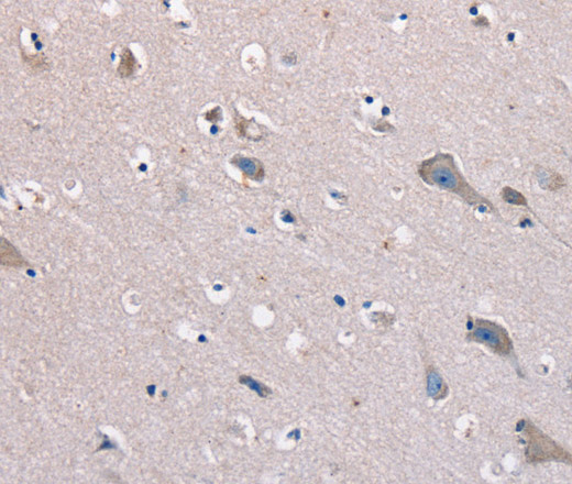 Immunohistochemistry of paraffin-embedded Human brain  tissue using KCNQ5 Polyclonal Antibody at dilution 1:60