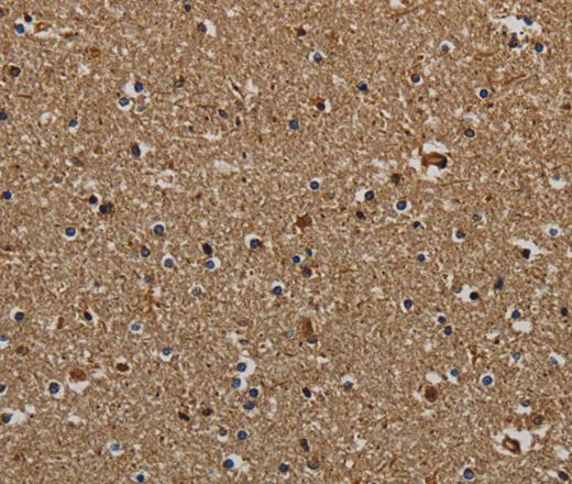 Immunohistochemistry of paraffin-embedded Human brain  tissue using KLK6 Polyclonal Antibody at dilution 1:60