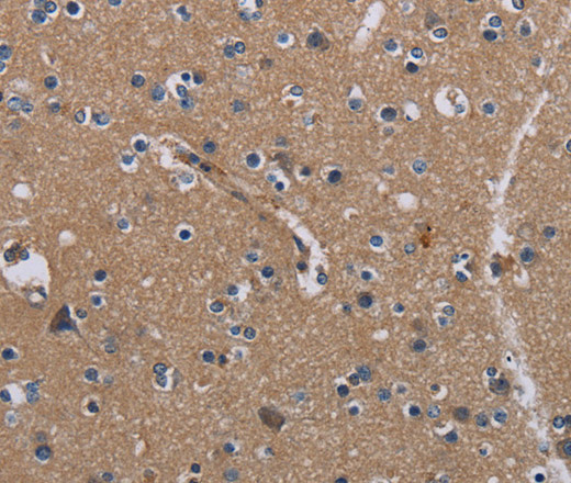 Immunohistochemistry of paraffin-embedded Human brain  tissue using PIDD1 Polyclonal Antibody at dilution 1:30