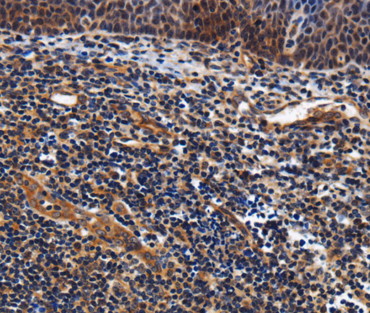 Immunohistochemistry of paraffin-embedded Human tonsil tissue using LRRC57 Polyclonal Antibody at dilution 1:40