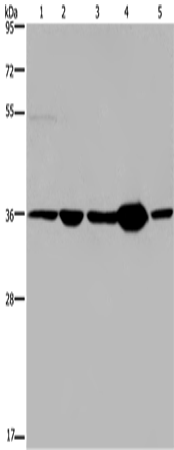 Western Blot analysis of Human transitional cell carcinoma tissue, 293T and A172 cell, Human testis tissue and Hela cell using LZTFL1 Polyclonal Antibody at dilution of 1:550