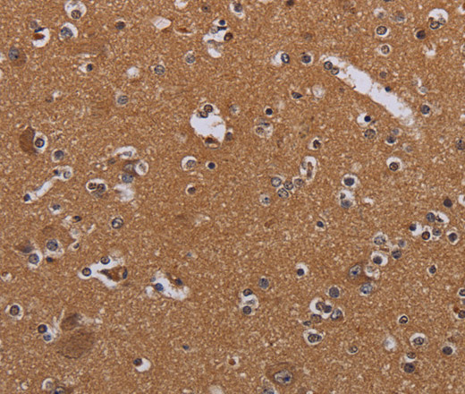 Immunohistochemistry of paraffin-embedded Human brain  tissue using MAGEB10 Polyclonal Antibody at dilution 1:60