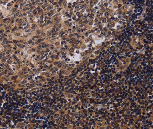 Immunohistochemistry of paraffin-embedded Human tonsil tissue using NTMT1 Polyclonal Antibody at dilution 1:40