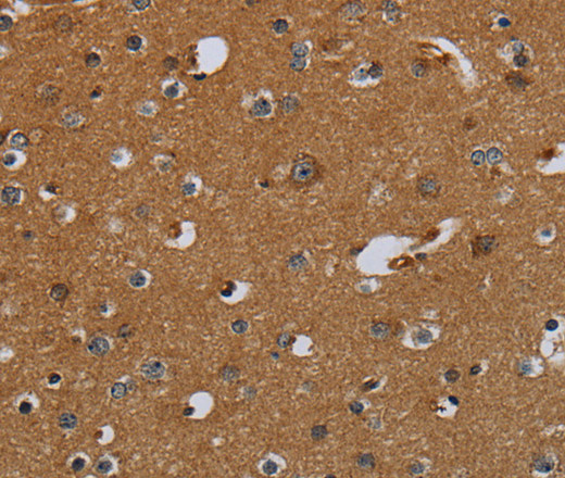 Immunohistochemistry of paraffin-embedded Human brain using PCK2 Polyclonal Antibody at dilution of 1:60