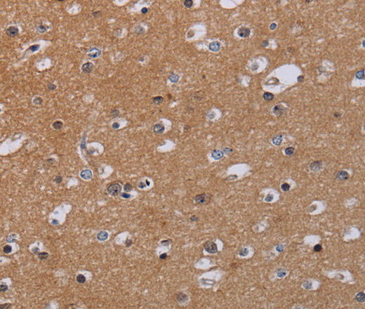 Immunohistochemistry of paraffin-embedded Human brain  tissue using MKKS Polyclonal Antibody at dilution 1:50