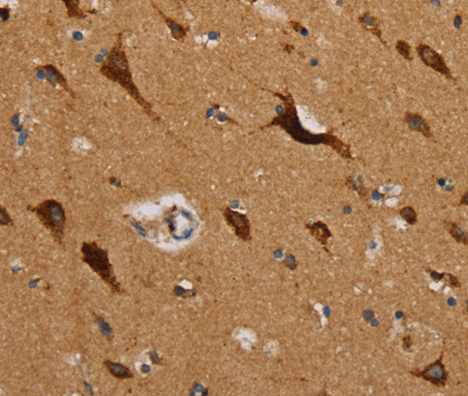 Immunohistochemistry of paraffin-embedded Human brain  using MRPL39 Polyclonal Antibody at dilution of 1:45