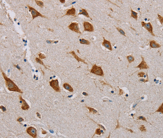 Immunohistochemistry of paraffin-embedded Human brain  tissue using CMC4 Polyclonal Antibody at dilution 1:55