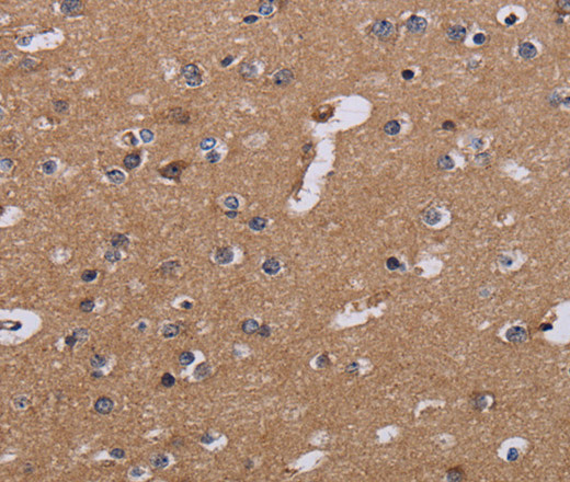 Immunohistochemistry of paraffin-embedded Human brain  tissue using NDUFA1 Polyclonal Antibody at dilution 1:30