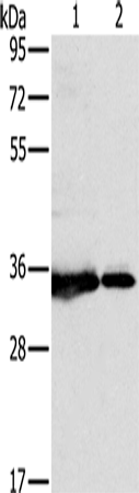 Western Blot analysis of 231 and Jurkat cell using NDUFAF1 Polyclonal Antibody at dilution of 1:500