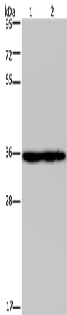 Western Blot analysis of Mouse heart and kidney tissue using NDUFA9 Polyclonal Antibody at dilution of 1:400