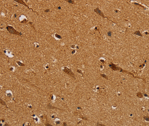 Immunohistochemistry of paraffin-embedded Human brain  using NDUFS5 Polyclonal Antibody at dilution of 1:50