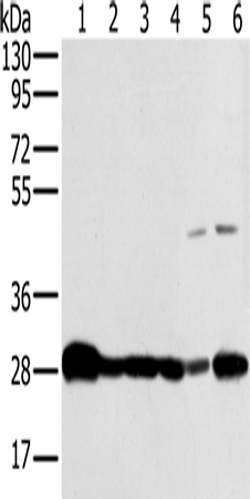 Western Blot analysis of Mouse brain and Human fetal brain tissue, hela, Raw264.7, NIH/3T3 and 293T cell using NDUFS3 Polyclonal Antibody at dilution of 1:300