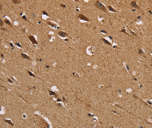 Immunohistochemistry of paraffin-embedded Human brain  using NDUFS1 Polyclonal Antibody at dilution of 1:50