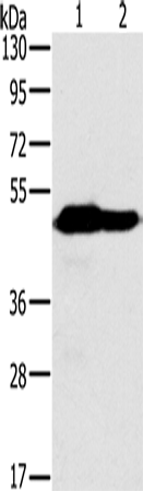 Western Blot analysis of Mouse heart and brain tissue using NDUFV1 Polyclonal Antibody at dilution of 1:500