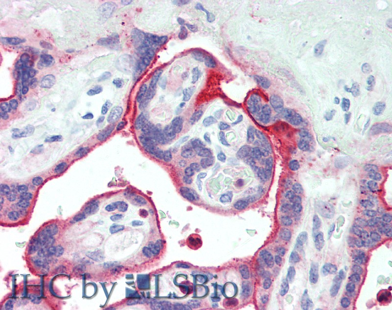 Immunohistochemistry of paraffin-embedded Human Placenta using NECTIN4 Polyclonal Antibody at dilution of 1:90.