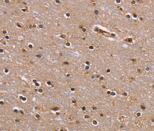 Immunohistochemistry of paraffin-embedded Human brain using GNL3 Polyclonal Antibody at dilution of 1:60