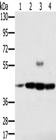 Western Blot analysis of Jurkat, Raji, K562 and hela cell using PAICS Polyclonal Antibody at dilution of 1:400