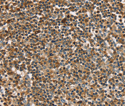 Immunohistochemistry of paraffin-embedded Human tonsil using PLS3 Polyclonal Antibody at dilution of 1:30