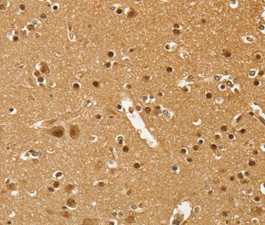 Immunohistochemistry of paraffin-embedded Human brain  using PSMC1 Polyclonal Antibody at dilution of 1:40