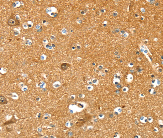 Immunohistochemistry of paraffin-embedded Human brain  using PYGL Polyclonal Antibody at dilution of 1:35