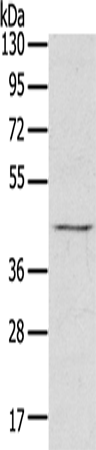 Western Blot analysis of Raji cell using RASSF7 Polyclonal Antibody at dilution of 1:800