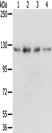 Western Blot analysis of Huvec, hepg2, 293T and A549 cell using RBM5 Polyclonal Antibody at dilution of 1:500