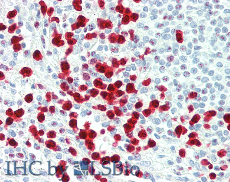 Immunohistochemistry of paraffin-embedded Spleen tissue using S100A12 Polyclonal Antibody at dilution of 1:60.