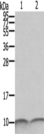 Western Blot analysis of SKOV3 and A431 cell using S100A6 Polyclonal Antibody at dilution of 1:550