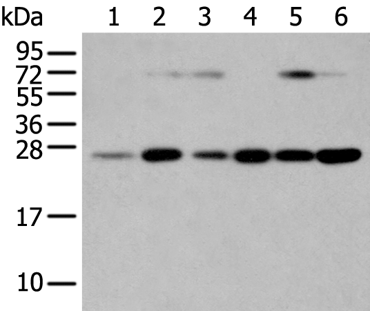 Western Blot analysis of Human placenta tissue and hela cell, hepg2 cell and Human fetal liver tissue, A549 cell and Human normal kidney tissue using SNAP23 Polyclonal Antibody at dilution of 1:400